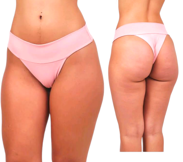 10 Calcinhas Fio Dental Feminino: Sensualidade e Conforto em um Só Produto